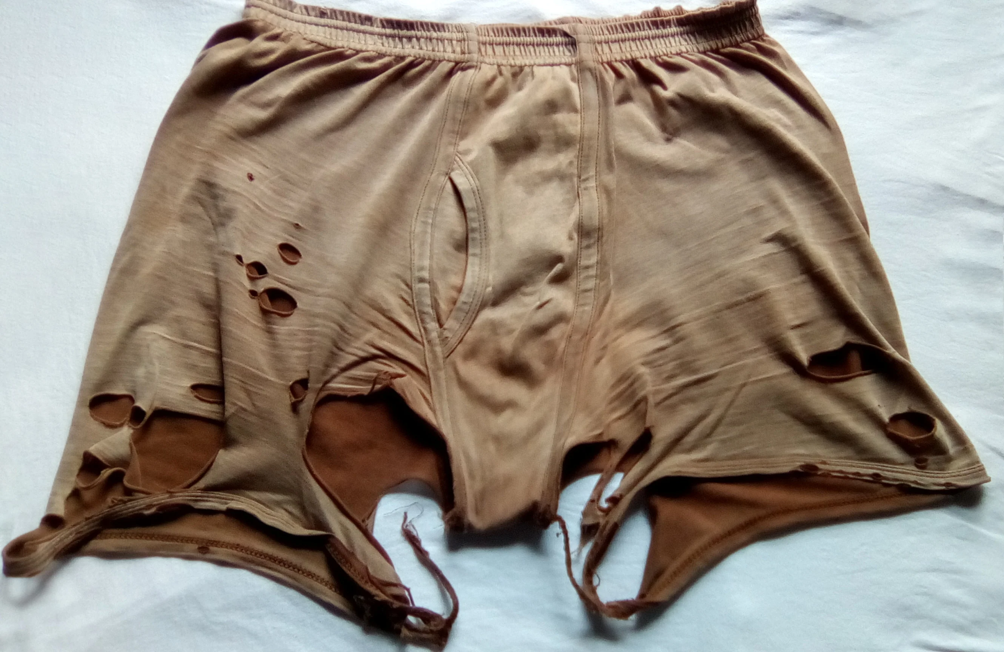 What’s up with men’s underwear?